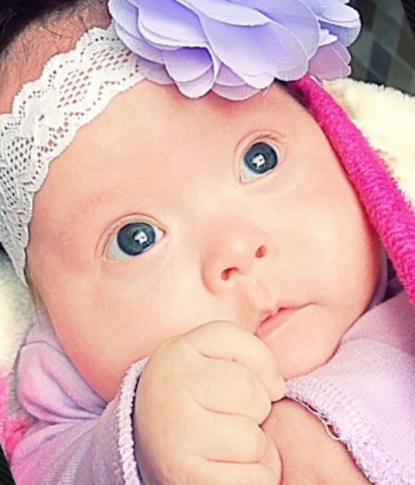 baby-with-down-syndrome-has-the-prettiest-eyes-cutest-babies